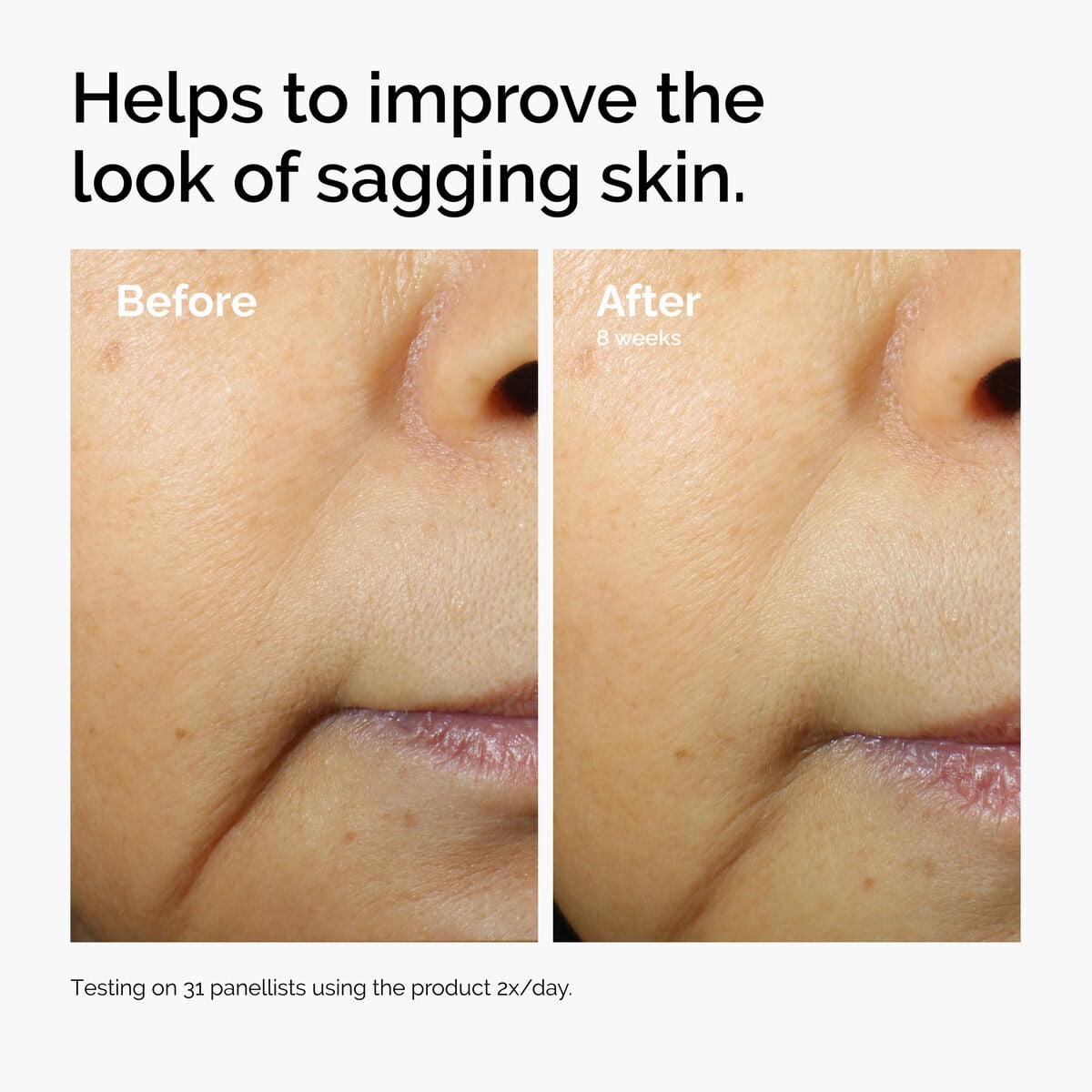 caffeine-3-escin-1-face-serum-f3 ord-caffeine-3pct-escin-1pct-face-serum-before-after-sagging.jpg