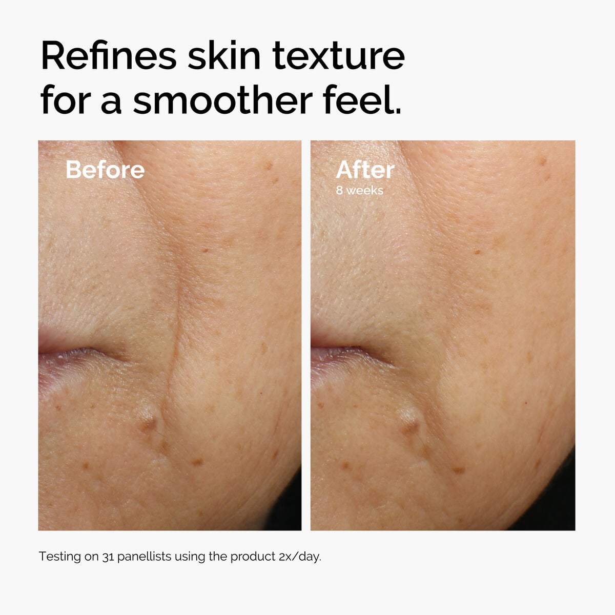 caffeine-3-escin-1-face-serum-f3 ord-caffeine-3pct-escin-1pct-face-serum-before-after-texture.jpg