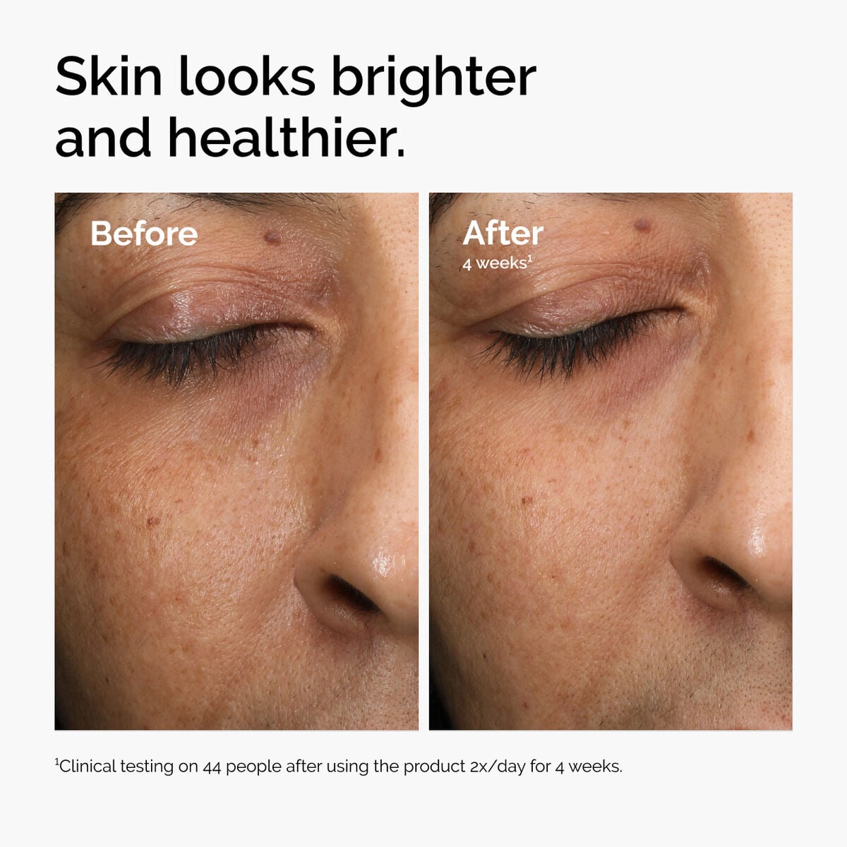 multi-antioxidant-radiance-serum-d1 ord-mars-before-after-healthy.jpg