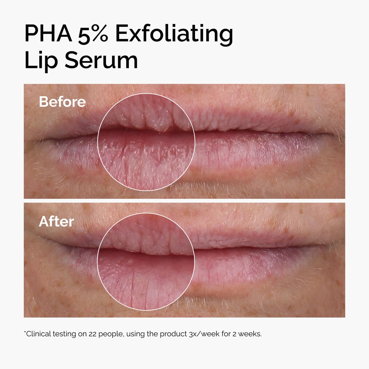 pha-5-exfoliating-lip-serum-x7 ord-pha-5pct-lip-exfoliating-serum-before-after.jpg